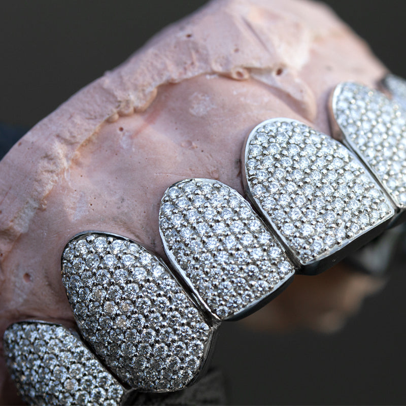 Fully Iced Out Diamond Grills - Fenom & Co.